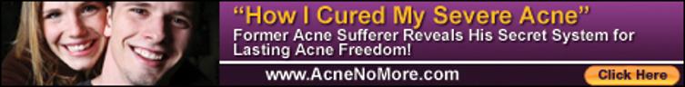 ACNE NO MORE